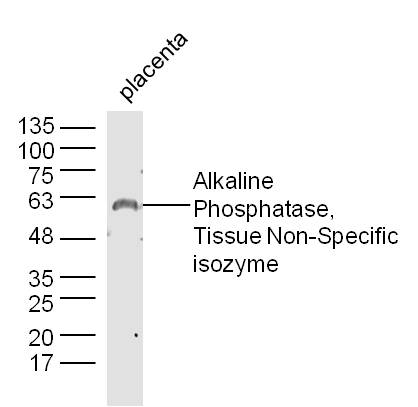 Mouse placenta lysates probed with AP-TNAP/ALPL Polyclonal Antibody, unconjugated (bs-1535R) at 1:300 overnight at 4°C followed by a conjugated secondary antibody at 1:10000 for 60 minutes at 37°C.