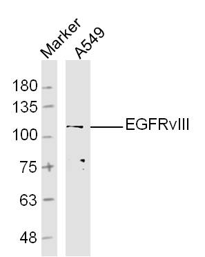 A549 Cells lysates probed with EGFRvIII Polyclonal Antibody, unconjugated (bs-2558R) at 1:300 overnight at 4\u00b0C followed by a conjugated secondary antibody at 1:10000 for 60 minutes at 37\u00b0C.