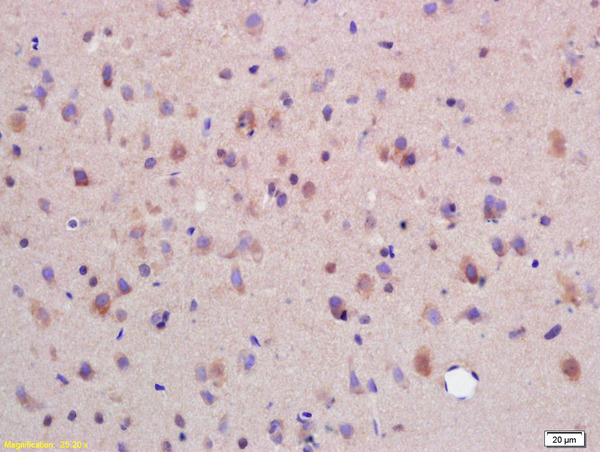 Formalin-fixed and paraffin embedded rat brain labeled with Rabbit Anti SYTL5/slp5 Polyclonal Antibody, Unconjugated (bs-4145R) at 1:200 followed by conjugation to the secondary antibody and DAB staining
