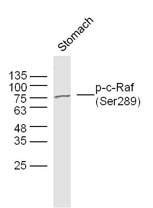 Mouse stomach lysates probed with c-Raf (Ser289) Polyclonal Antibody, unconjugated (bs-3372R) at 1:300 overnight at 4°C followed by a conjugated secondary antibody at 1:10000 for 90 minutes at 37°C.