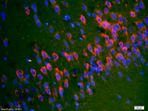 Formalin-fixed and paraffin-embedded rat brain labeled with Anti-SYTL5/slp5 Polyclonal Antibody, Unconjugated(bs-4145R) 1:200, overnight at 4°C, The secondary antibody was Goat Anti-Rabbit IgG, Cy3 conjugated(bs-0295G-Cy3)used at 1:200 dilution for 40 minutes at 37°C.
