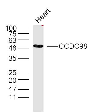Mouse heart lysates probed with CCDC98 Polyclonal Antibody, unconjugated (bs-6921R) at 1:300 overnight at 4°C followed by a conjugated secondary antibody at 1:10000 for 90 minutes at 37°C.