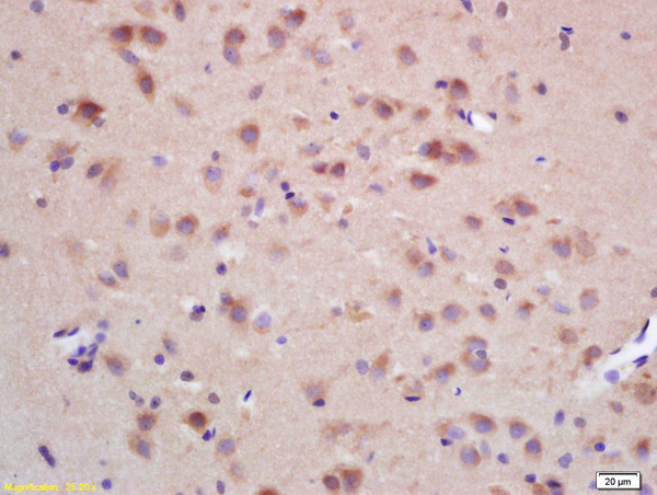 Formalin-fixed and paraffin embedded rat brain labeled with Rabbit Anti CHRNB2 Polyclonal Antibody, Unconjugated (bs-4247R) at 1:200 followed by conjugation to the secondary antibody and DAB staining