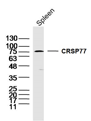 Mouse spleen lysates probed with CRSP77 Polyclonal Antibody, unconjugated (bs-11437R) at 1:300 overnight at 4°C followed by a conjugated secondary antibody at 1:10000 for 90 minutes at 37°C.