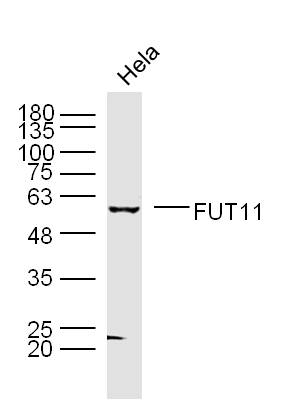 Human Hela cells probed with Fut11 Polyclonal Antibody, unconjugated (bs-12259R) at 1:300 overnight at 4°C followed by a conjugated secondary antibody at 1:10000 for 90 minutes at 37°C.