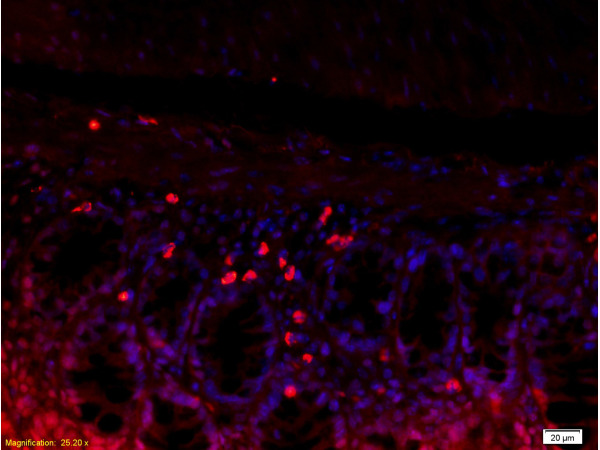 Formalin-fixed and paraffin embedded mouse kidney tissue labeled with Rabbit Anti-L-Selectin/CD62L Polyclonal Antibody (bs-1036R), Unconjugated 1:200 followed by conjugation to the secondary antibody and DAB staining