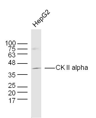 Human HepG2 cells probed with CK II alpha Polyclonal Antibody, unconjugated (bs-1607R) at 1:300 overnight at 4°C followed by a conjugated secondary antibody at 1:10000 for 90 minutes at 37°C.\n