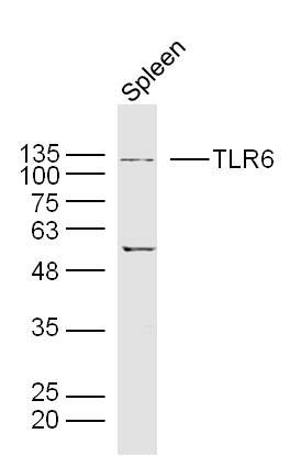 Rat spleen lysates probed with TLR6 Polyclonal Antibody, unconjugated (bs-2716R) at 1:300 overnight at 4°C followed by a conjugated secondary antibody at 1:10000 for 90 minutes at 37°C.\n