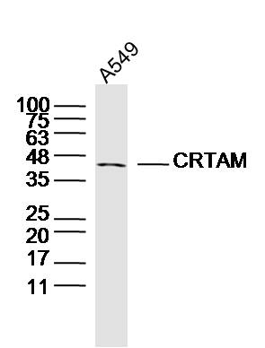 Human A549 cells probed with CRTAM Polyclonal Antibody, unconjugated (bs-4957R) at 1:300 overnight at 4°C followed by a conjugated secondary antibody at 1:10000 for 90 minutes at 37°C.