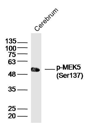 Rat brain lysates probed with MEK5(Ser137) Polyclonal Antibody, unconjugated (bs-5432R) at 1:300 overnight at 4°C followed by a conjugated secondary antibody at 1:10000 for 90 minutes at 37°C.