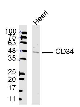 Mouse heart lysates probed with CD34 Polyclonal Antibody, unconjugated (bs-0646R) at 1:300 overnight at 4\u00b0C followed by a conjugated secondary antibody at 1:10000 for 90 minutes at 37\u00b0C.