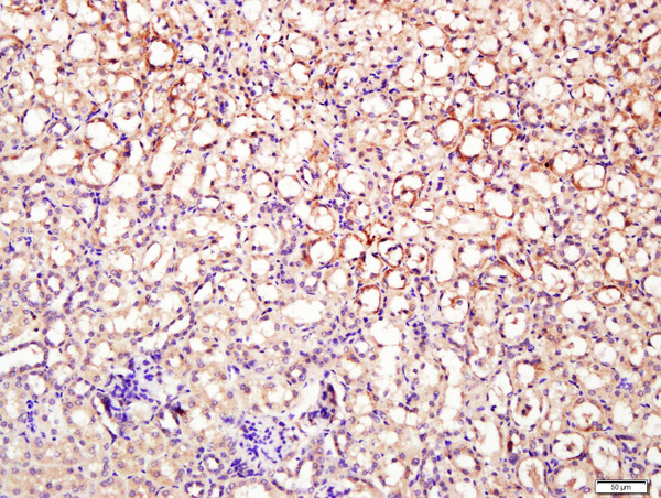 Paraformaldehyde-fixed, paraffin embedded mouse kidney tissue; Antigen retrieval by boiling in sodium citrate buffer(pH6) for 15min; Block endogenous peroxidase by 3% hydrogen peroxide for 30 minutes; Blocking buffer (normal goat serum) at 37°C for 20min; Antibody incubation with Rabbit Anti-DNase II Polyclonal Antibody, Unconjugated (bs-7652R) at 1:400 overnight at 4°C, followed by a conjugated secondary and DAB staining\n