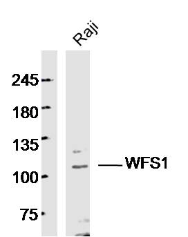 Human Raji cells probed with WFS1 Polyclonal Antibody, unconjugated (bs-11272R) at 1:300 overnight at 4°C followed by a conjugated secondary antibody at 1:10000 for 90 minutes at 37°C.