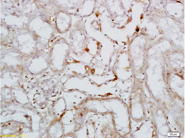 Formalin-fixed and paraffin embedded rat colitis tissue labeled with Rabbit Anti-L-Selectin\/CD62L Polyclonal Antibody (bs-1036R), Unconjugated 1:200 followed by conjugation to the secondary antibody and DAB staining
