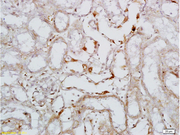 Formalin-fixed and paraffin embedded rat colitis tissue labeled with Rabbit Anti-L-Selectin/CD62L Polyclonal Antibody (bs-1036R), Unconjugated 1:200 followed by conjugation to the secondary antibody and DAB staining
