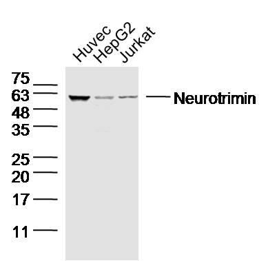 Human Huvec, HepG2, and Jurkat cells probed with Neurotrimin Polyclonal Antibody, unconjugated (bs-11082R) at 1:300 overnight at 4°C followed by a conjugated secondary antibody at 1:10000 for 90 minutes at 37°C.