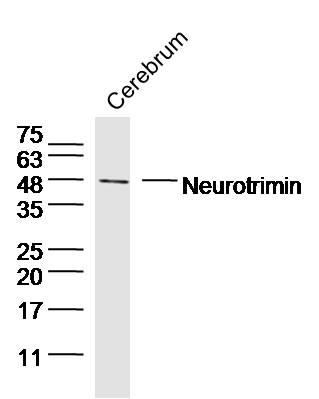 Mouse brain lysates probed with Neurotrimin Polyclonal Antibody, unconjugated (bs-11082R) at 1:300 overnight at 4°C followed by a conjugated secondary antibody at 1:10000 for 90 minutes at 37°C.