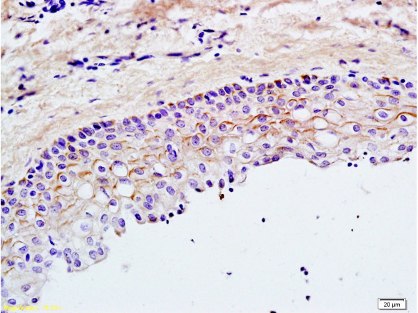 Formalin-fixed and paraffin embedded rat ovary tissue labeled with Rabbit Anti-TLR2/CD282 Polyclonal Antibody (bs-1019R), Unconjugated 1:200 followed by conjugation to the secondary antibody and DAB staining