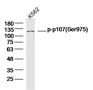 Human K562 cells probed with p107(Ser975) Polyclonal Antibody, unconjugated (bs-5696R) at 1:300 overnight at 4°C followed by a conjugated secondary antibody at 1:10000 for 90 minutes at 37°C.