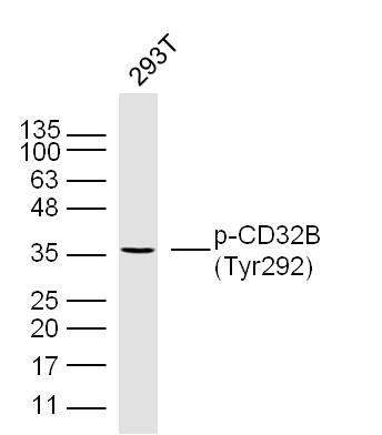 Human 293T cells probed with CD32B(Tyr292) Polyclonal Antibody, unconjugated (bs-6031R) at 1:300 overnight at 4°C followed by a conjugated secondary antibody at 1:10000 for 90 minutes at 37°C. Human 293T cells probed with CD32B(Tyr292) Polyclonal Antibody, unconjugated (bs-6031R) at 1:300 overnight at 4°C followed by a conjugated secondary antibody at 1:10000 for 90 minutes at 37°C.