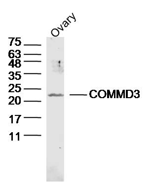 Mouse ovary lysates probed with COMMD3 Polyclonal Antibody, unconjugated (bs-8183R) at 1:300 overnight at 4°C followed by a conjugated secondary antibody at 1:10000 for 90 minutes at 37°C.