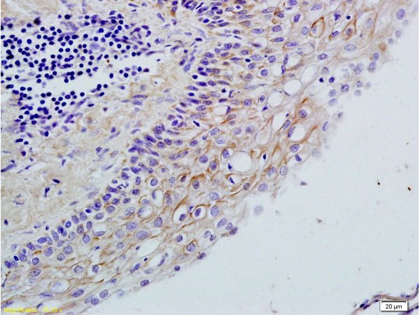 Formalin-fixed and paraffin embedded rat ovary tissue labeled with Rabbit Anti-TLR2/CD282 Polyclonal Antibody (bs-1019R), Unconjugated 1:200 followed by conjugation to the secondary antibody and DAB staining