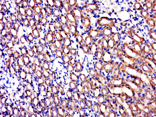 Paraformaldehyde-fixed, paraffin embedded rat kidney; Antigen retrieval by boiling in sodium citrate buffer (pH6.0) for 15min; Block endogenous peroxidase by 3% hydrogen peroxide for 20 minutes; Blocking buffer (normal goat serum) at 37°C for 30min; Antibody incubation with C1orf69 Polyclonal Antibody, Unconjugated (bs-15075R) at 1:500 overnight at 4°C, followed by a conjugated secondary for 20 minutes and DAB staining