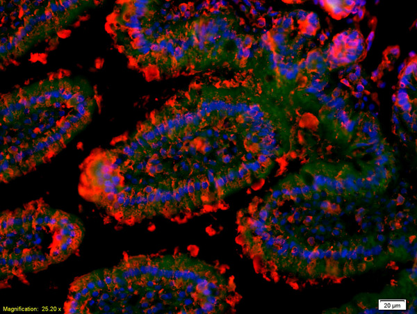 Formalin-fixed and paraffin-embedded mouse intestine labeled with Anti-GM-CSFR alpha/CD116/CSF2RA Polyclonal Antibody, Unconjugated(bs-1457R) 1:200, overnight at 4°C, The secondary antibody was Goat Anti-Rabbit IgG, Cy3 conjugated(bs-0295G-Cy3)used at 1:200 dilution for 40 minutes at 37°C.