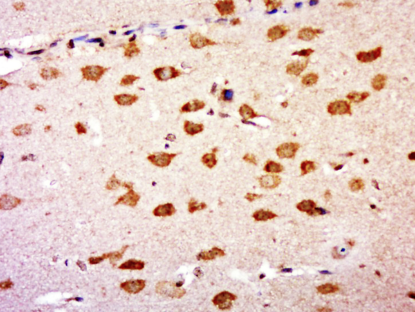 Paraformaldehyde-fixed, paraffin embedded rat brain; Antigen retrieval by boiling in sodium citrate buffer (pH6.0) for 15min; Block endogenous peroxidase by 3% hydrogen peroxide for 20 minutes; Blocking buffer (normal goat serum) at 37°C for 30min; Antibody incubation with GNB5 Polyclonal Antibody, Unconjugated (bs-13466R) at 1:500 overnight at 4°C, followed by a conjugated secondary for 20 minutes and DAB staining.