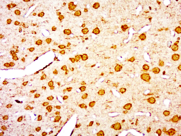 Paraformaldehyde-fixed, paraffin embedded rat brain; Antigen retrieval by boiling in sodium citrate buffer (pH6.0) for 15min; Block endogenous peroxidase by 3% hydrogen peroxide for 20 minutes; Blocking buffer (normal goat serum) at 37°C for 30min; Antibody incubation with FOXRED1 Polyclonal Antibody, Unconjugated (bs-13209R) at 1:400 overnight at 4°C, followed by a conjugated secondary for 20 minutes and DAB staining.