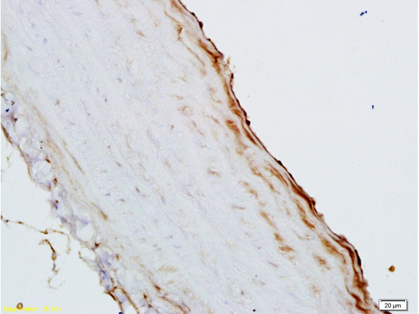 Formalin-fixed and paraffin embedded rat aortic cavity labeled with Rabbit Anti-GM-CSF Polyclonal Antibody (bs-0999R), Unconjugated 1:200 followed by conjugation to the secondary antibody and DAB staining