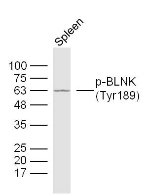 Mouse spleen lysates probed with BLNK(Tyr189) Polyclonal Antibody, unconjugated (bs-9688R) at 1:300 overnight at 4°C followed by a conjugated secondary antibody at 1:10000 for 90 minutes at 37°C.