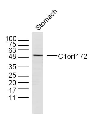 Mouse stomach lysates probed with C1orf172 Polyclonal Antibody, unconjugated (bs-9781R) at 1:300 overnight at 4°C followed by a conjugated secondary antibody at 1:10000 for 90 minutes at 37°C.