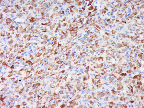 Paraformaldehyde-fixed, paraffin embedded rat ovary; Antigen retrieval by boiling in sodium citrate buffer (pH6.0) for 15min; Block endogenous peroxidase by 3% hydrogen peroxide for 20 minutes; Blocking buffer (normal goat serum) at 37°C for 30min; Antibody incubation with \tWRB Polyclonal Antibody, Unconjugated (bs-11774R) at 1:600 overnight at 4°C, followed by a conjugated secondary for 20 minutes and DAB staining