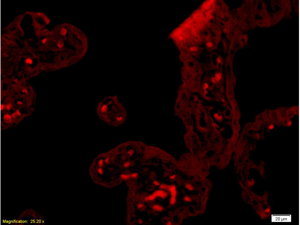 Formalin-fixed and paraffin embedded human placenta tissue labeled with Rabbit Anti-GM-CSF Polyclonal Antibody (bs-0999R), Unconjugated 1:200 followed by conjugation to the secondary antibody and DAB staining Formalin-fixed and paraffin embedded human placenta tissue labeled with Rabbit Anti-GM-CSF Polyclonal Antibody (bs-0999R), Unconjugated 1:200 followed by conjugation to the secondary antibody and DAB staining