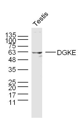 Mouse testis lysates probed with DGKE Polyclonal Antibody, unconjugated (bs-12999R) at 1:300 overnight at 4°C followed by a conjugated secondary antibody at 1:10000 for 90 minutes at 37°C.