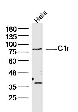 Human Hela cells probed with C1r Polyclonal Antibody, unconjugated (bs-15086R) at 1:300 overnight at 4°C followed by a conjugated secondary antibody at 1:10000 for 90 minutes at 37°C.