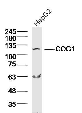 Lane 1: HepG2 lysates probed with COG1 Polyclonal Antibody, Unconjugated (bs-6647R) at 1:300 overnight at 4˚C. Followed by a conjugated secondary antibody at 1:10000 for 90 min at 37˚C.