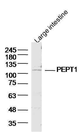 Mouse large intestine lysates probed with PEPT1 Polyclonal Antibody, unconjugated (bs-0689R) at 1:300 overnight at 4\u00b0C followed by a conjugated secondary antibody at 1:10000 for 90 minutes at 37\u00b0C.