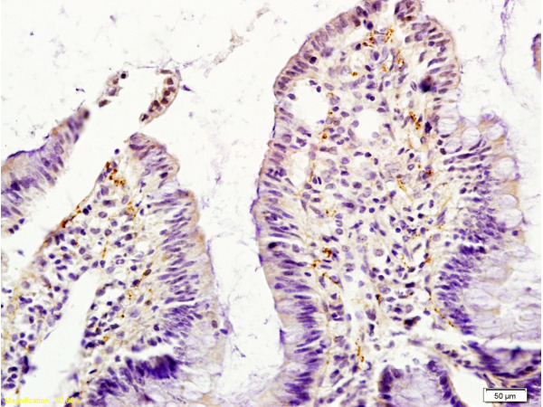Formalin-fixed and paraffin embedded rat intestine tissue labeled with Anti-GM-CSF Polyclonal Antibody (bs-0999R), Unconjugated at 1:200, followed by conjugation to the secondary antibody and DAB staining Formalin-fixed and paraffin embedded rat intestine tissue labeled with Anti-GM-CSF Polyclonal Antibody (bs-0999R), Unconjugated at 1:200, followed by conjugation to the secondary antibody and DAB staining