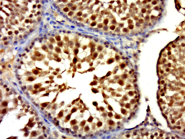 Paraformaldehyde-fixed, paraffin embedded rat testis; Antigen retrieval by boiling in sodium citrate buffer (pH6.0) for 15min; Block endogenous peroxidase by 3% hydrogen peroxide for 20 minutes; Blocking buffer (normal goat serum) at 37°C for 30min; Antibody incubation with RNF6 Polyclonal Antibody, Unconjugated (bs-9172R) at 1:500 overnight at 4°C, followed by a conjugated secondary for 20 minutes and DAB staining.
