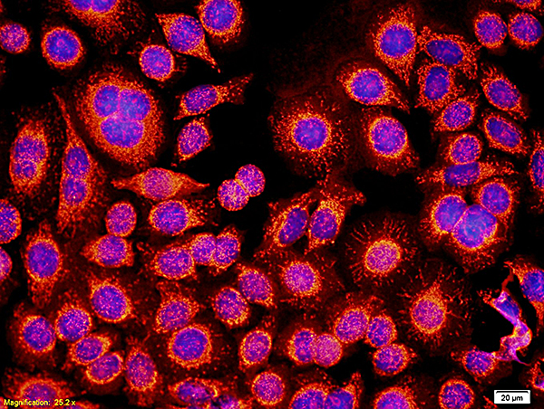 Human Myeloma cells labeled with Anti-GM-CSFR alpha/CD116/CSF2RA Polyclonal Antibody, Unconjugated (bs-1457R) followed by incubation with conjugated secondary antibody and DAPI staining