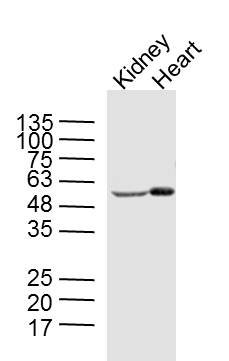 Mouse kidney and heart lysates probed with AMPK alpha 2 Polyclonal Antibody, unconjugated (bs-5575R) at 1:300 overnight at 4°C followed by a conjugated secondary antibody at 1:10000 for 90 minutes at 37°C.