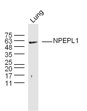 Mouse lung lysates probed with NPEPL1 Polyclonal Antibody, Unconjugated bs-19327R at 1:300 overnight at 4˚C. Followed by a conjugated secondary antibody (bs-0295G-HRP) at 1:5000 for 90 min at 37˚C.