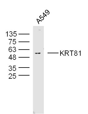 A594 lysates probed with KRT81 Polyclonal Antibody, Unconjugated bs-20249R at 1:300 overnight at 4˚C. Followed by a conjugated secondary antibody (bs-0295G-HRP) at 1:5000 for 90 min at 37˚C.