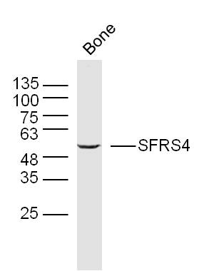 Mouse bone lysates probed with SFRS4 Polyclonal Antibody, Unconjugated bs-17300R at 1:300 overnight at 4˚C. Followed by a conjugated secondary antibody (bs-0295G-HRP) at 1:5000 for 90 min at 37˚C.