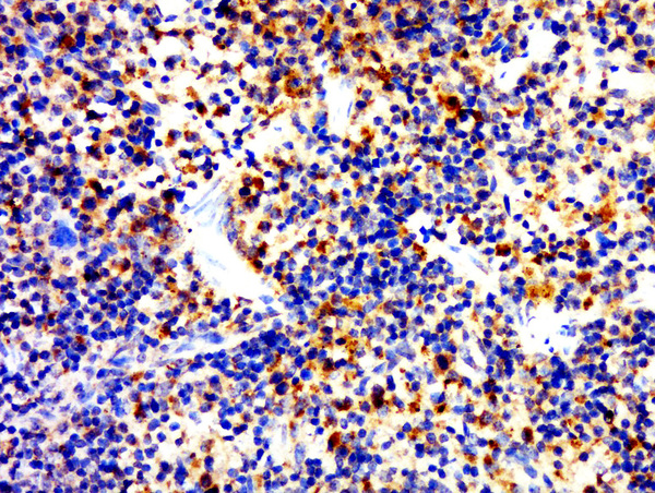 Paraformaldehyde-fixed, paraffin embedded rat spleen; Antigen retrieval by boiling in sodium citrate buffer (pH6.0) for 15min; Block endogenous peroxidase by 3% hydrogen peroxide for 20 minutes; Blocking buffer (normal goat serum) at 37°C for 30min; Antibody incubation with CD4 Polyclonal Antibody, Unconjugated (bs-0766R) at 1:400 overnight at 4°C, followed by a conjugated secondary for 20 minutes and DAB staining.