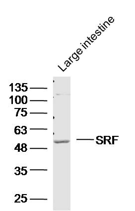 Mouse large intestine lysates probed with Polyclonal Antibody, unconjugated (bs-1401R) at 1:300 overnight at 4°C followed by a conjugated secondary antibody at 1:10000 for 90 minutes at 37°C.
