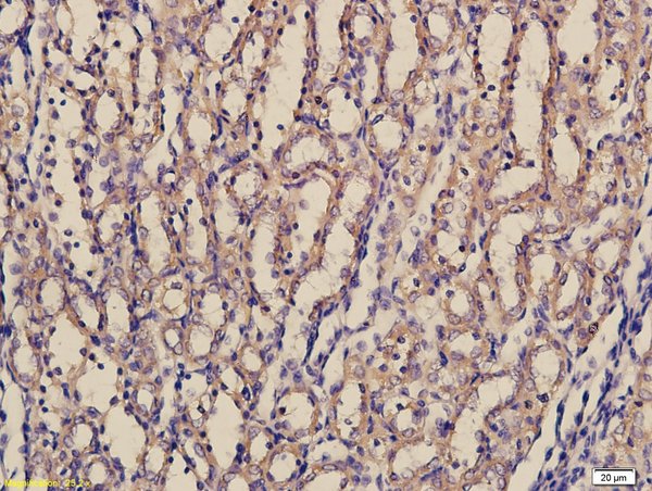 Formalin-fixed and paraffin embedded rat kidney tissue labeled with Rabbit Anti-laminin Polyclonal Antibody, Unconjugated(bs-0821R) followed by conjugation to the secondary antibody and DAB staining.