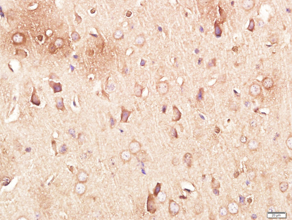 Paraformaldehyde-fixed, paraffin embedded mouse brain tissue; Antigen retrieval by boiling in sodium citrate buffer(pH6) for 15min; Block endogenous peroxidase by 3% hydrogen peroxide for 30 minutes; Blocking buffer (normal goat serum) at 37°C for 20min; Antibody incubation with Rabbit Anti-Neurotrimin Polyclonal Antibody, Unconjugated (bs-11082R) at 1:300 overnight at 4°C, followed by a conjugated secondary and DAB staining